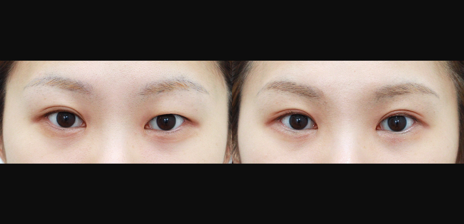 자연유착